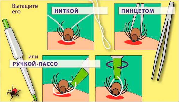 ”Укус